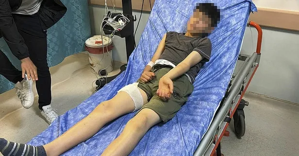 Başıboş köpekler Sivas’ta dehşet saçtı! 13 yaşındaki küçük çocuk canını zor kurtardı: Hastaneye kaldırıldı