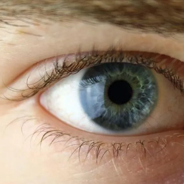 Sık sık gözlerı kırpın