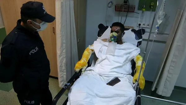 1605774743696.jpg Ailesini kurtardı kendisi yandı! Samsun'da inanılmaz fedakarlık-2
