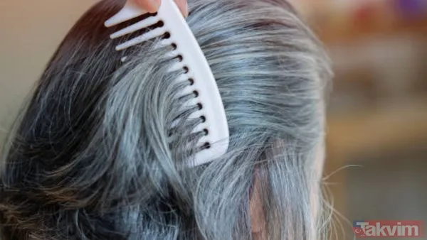 Saçlarınız neden erken beyazlıyor? Genetik mi, stres mi? Cevabı şaşırtacak… - 3