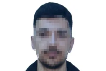 Barışma teklifini reddeden eski sevgilisinin yüzüne kezzap atarak dehşet saçtı
