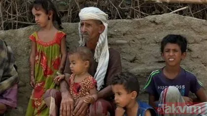Genetik bozukluk Yemen’de bir köyü kör etti