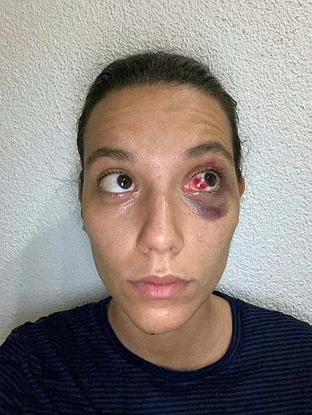 Halit Ergenç'ten Deniz Bulutsuz'u acımasızca darp eden Ozan Güven'e skandal destek!-6