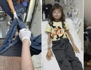 Çöp evde bulunan çocuk olayında yeni gelişme