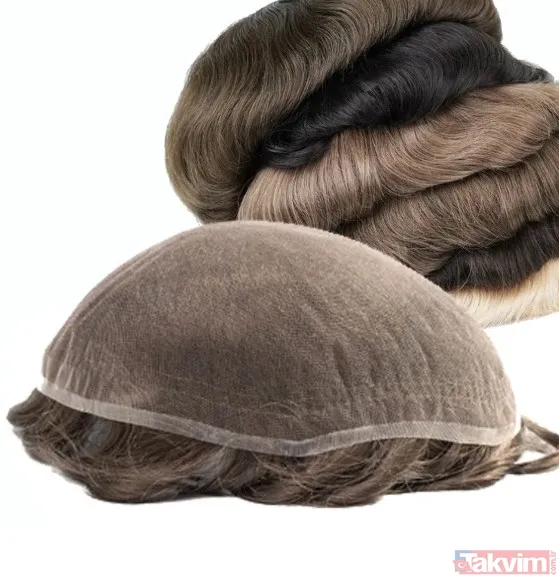 Peki Neden Saç Dökülüyor? Uzmanlara Göre Saç Dökülmesinin En Yaygın Nedeni Androjenetik Alopesi, Yani Erkek Tipi Kellik. Genetik Yatkınlık, Hormonlar (Özellikle...