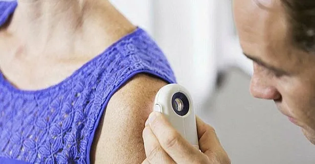 Uzmanı güneşli havalarda yapılması gerekenler konusunda uyarılarda bulundu