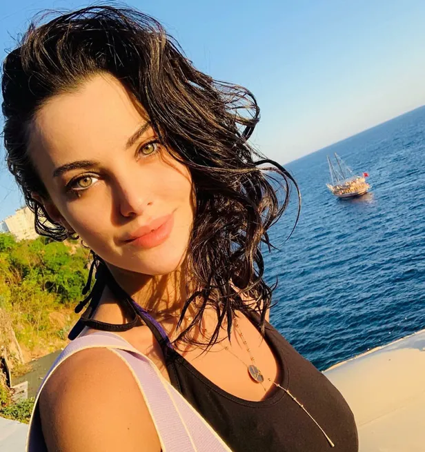 Tuvana Türkay'ın estetiksiz görenler donup kalıyor! İşte ünlü oyuncunun şoke eden değişimi...-7