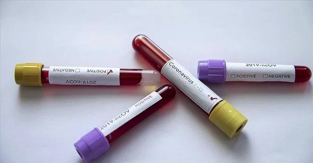 Koronavirüste son durum: 1.491 yeni vaka var