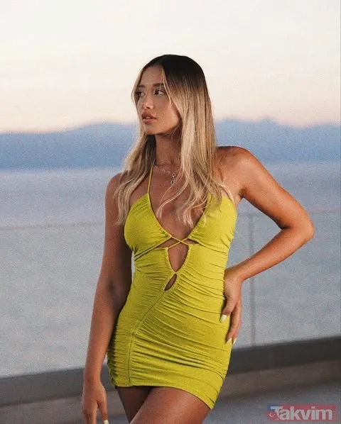 Survivor Aleyna Kalaycıoğlu kötü haberi duyurdu! “Dişleri döküldü” - 7