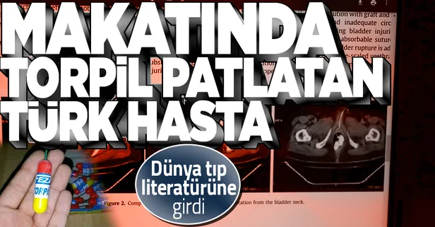 Denizli Tavas'ta makatına torpil yerleştirip patlatan adam tıp literatürüne girdi