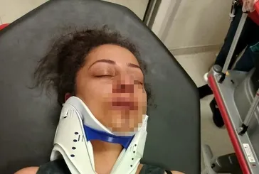 Komşuların kanlı pitbull kavgası