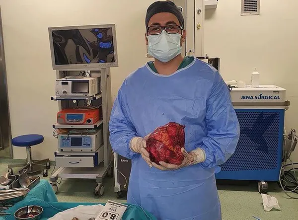 halsizlik-ve-bas-donmesi-sikayetiyle-gitti-karnindan-20-santimlik-kitle-cikarildi-1649935743115.jpg Halsizlik ve baş dönmesi şikayetiyle gitti karnından 20 santimlik kitle çıkarıldı-7