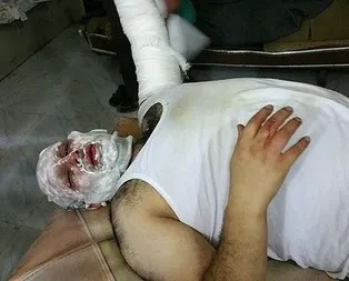 AA muhabiri Suriye’de ölümden döndü