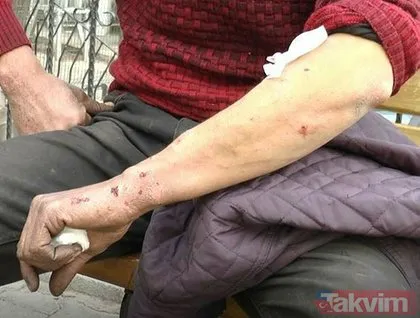 Gaziantep’te ikinci pitbull vakası! Saldırıya uğrayan talihsiz adam konuştu: Kendimi kurtaramasam parçalayıp öldürürdü