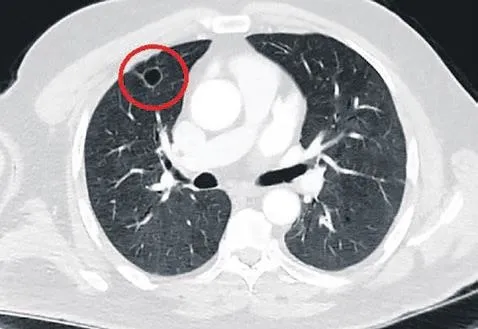 Dünya tıp literatüründe bir ilk yaşandı! Sütçü İmam Üniversite Hastanesi'nde kanser sanılan hasta, Covid'li çıktı-2
