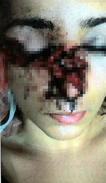 İzmir'de Tuğçe Aras ayrılmak isteyince önce gözünü kaybetti ardından koku alma duygusunu-1