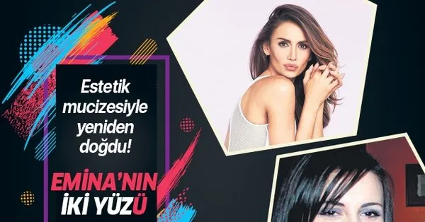emina sandal in estetiksiz hali olay oldu guzellik ugruna bir ev parasi harcadi takvim