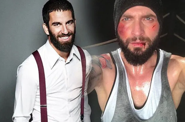 Arda Turan'ın burnunu kırdığı Berkay'ın doktorundan ilk açıklama