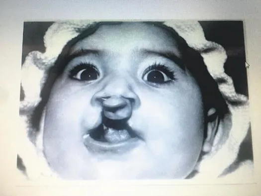 Dudak damak yarığıyla doğdu, sayısız ameliyattan sonra iyileşti! Kendisi gibi doğanları ücretsiz tedavi etti-1