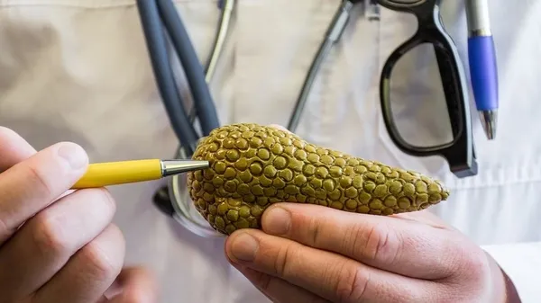 Pankreas kanserini yanlış anlama: Pankreas kanserinin belirtileri nelerdir?-5