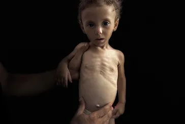 Gazzeliler açlıktan ölüyor!