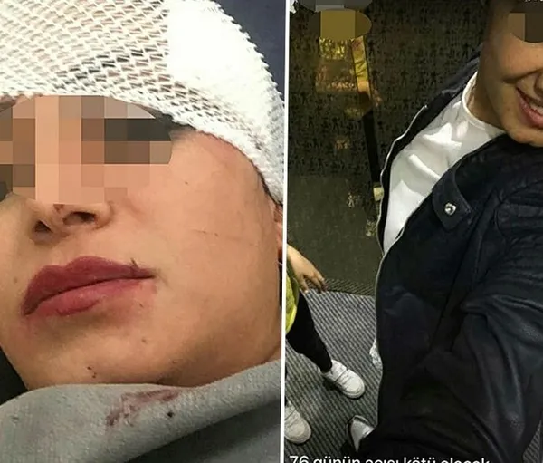 jiletle-yuzunu-parcaladi-konyada-gazinoda-sevgilisiyle-gordugu-kiz-arkadasina-saldirdi-1643694856817.jpg