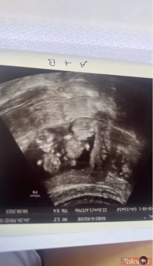 Yasemin Şefkatli Tatlıses "İkizlerin adını İdo koydu benim de içime sindi" dedi paylaştı! İkiz erkek bebek bekleyen güzel anne Yasemin... - 15