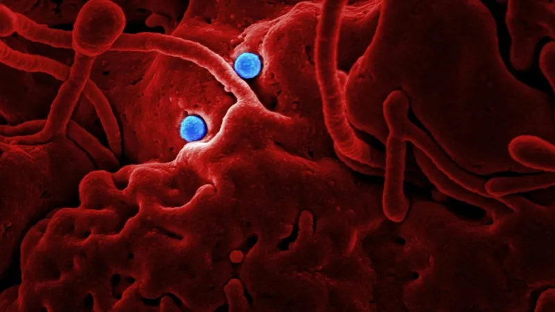 milyonda-bir-goruluyor-ama-olum-riski-tasiyor-iste-guillain-barre-sendromunun-belirtileri-1768390973877.jpg Milyonda bir görülüyor ama ölüm riski taşıyor-7