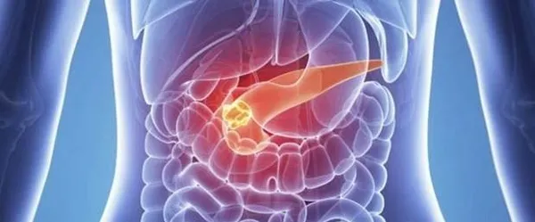Pankreas kanserinde erken teşhis hayati önem taşıyor! Pankreas kanserinde şifanın rengi yeşil-2