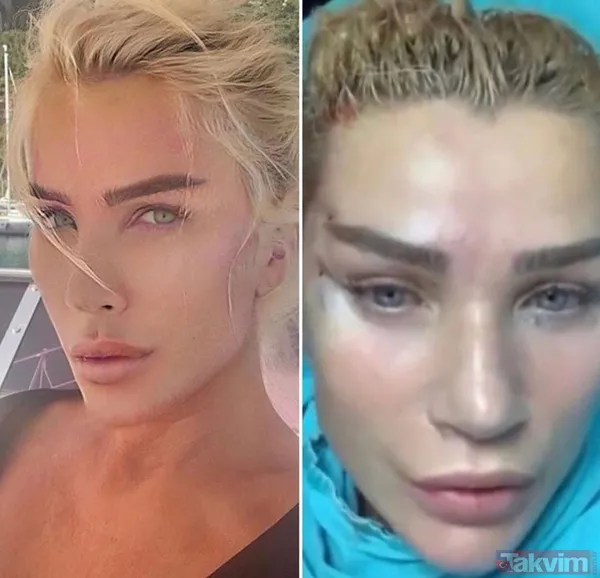 Safiye Soyman'ın son haline bakın "20 yıl geriye gittim genç kız gibi oldum" Seda Sayan'ın 'kobayı' Safiye estetikten sonra... - 35