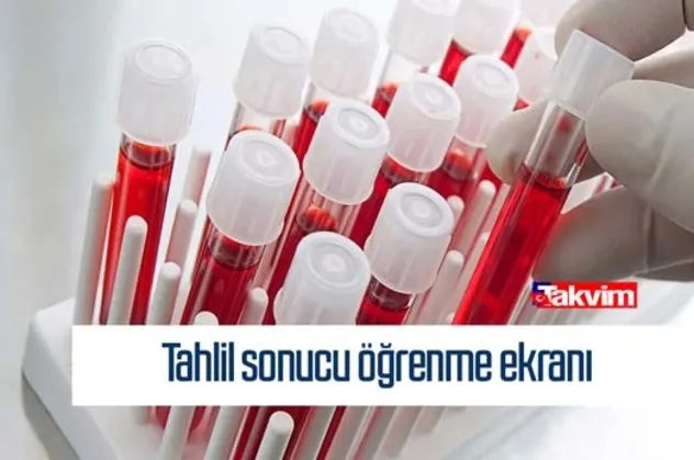 T.C. kimlik no ile tahlil sonucu öğrenme! Korona test sonucu - covid test sonucu sorgulama