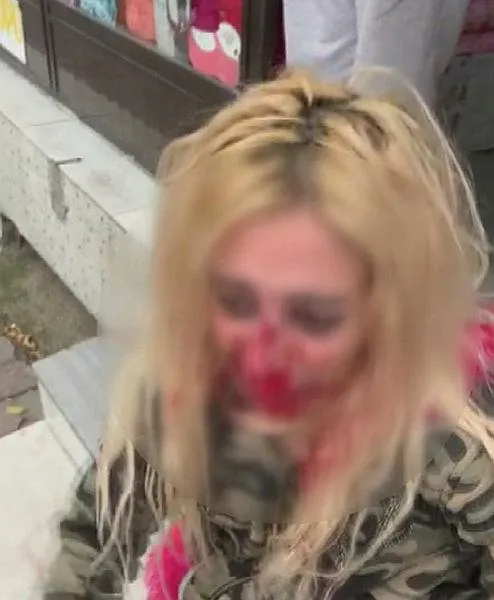 SON DAKİKA: Gaziosmanpaşa'da dehşet: Kadına kafa atarak kanlar içinde bıraktı-3