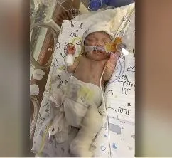 Önce bacağından sonra canından olan Ömer bebek (takvim.com.tr | Ekran Görüntüsü)