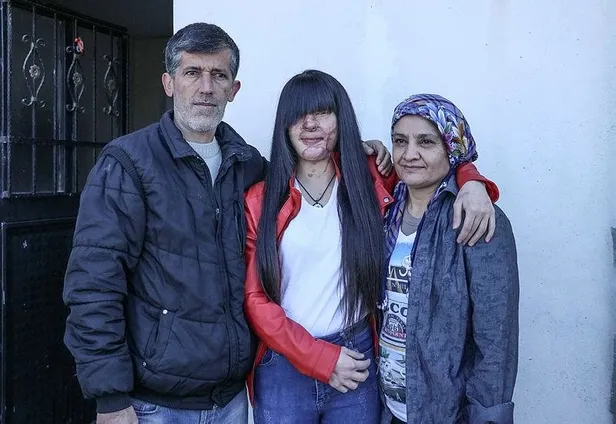 Berfin Özek kendisine asitle saldıran Casim Ozan Çeltik'le neden evlendi? Babası konuştu: Onaylamıyorum-10