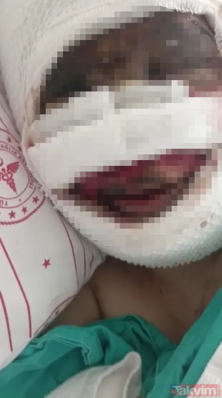 Gaziantep'te dehşet: Adem Külah eski eşini koli bandı ile bağlayıp başından aşağı kezzap döktü! - 8