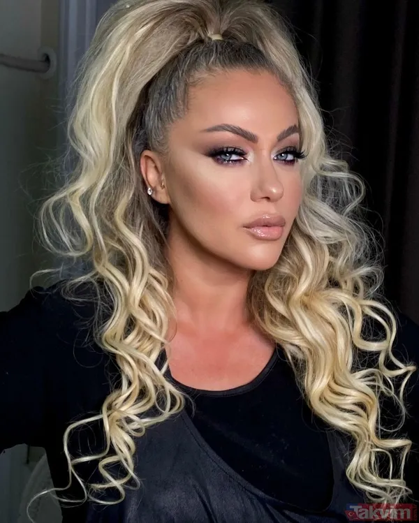 Murat Kurşun’dan estetik itirafı! Son hali dikkat çekti! Rafet El Roman ve Gökhan Özen’in ardından... - 27