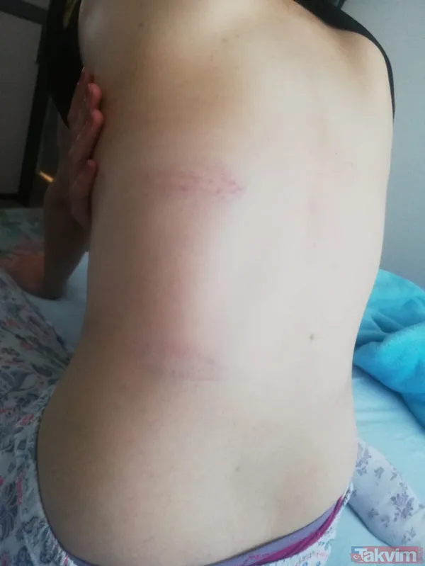 Konya'da iki kadın tarafından kaçırılıp işkence edilen Demet A dehşet anlarını anlattı! 'Evden çıkamayacağım sandım' - 8