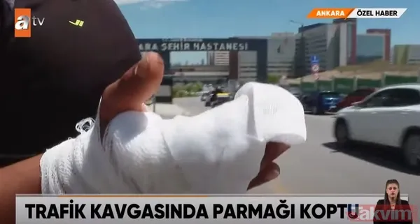 Ankara'da inanılmaz olay! Trafik kavgasında parmağını kopardılar - 2