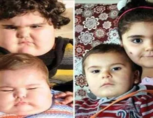 4 yaşında ama 15 kilo verdi