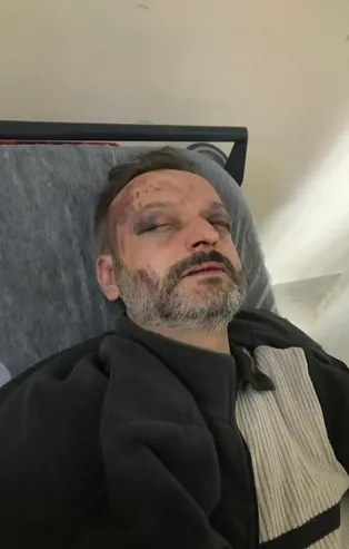 Onur Şener cinayetini hatırlatan saldırı: "İstek parçayı çalmadın" diyerek öldüresiye dövdüler