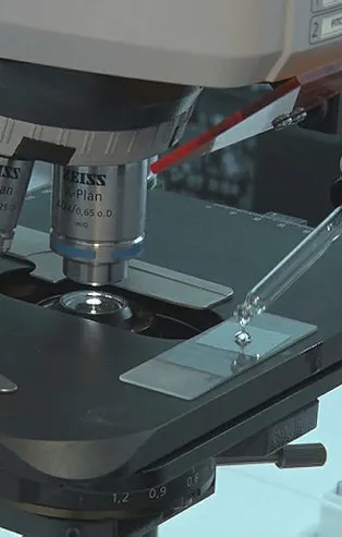 Türkiye'de bir ilk olacak! TÜBİTAK destek verdi! Kan uyuşmazlığı tedavisinde kesin çözüm