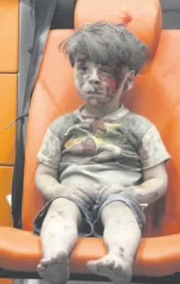 Ümran bebek komada iddiası