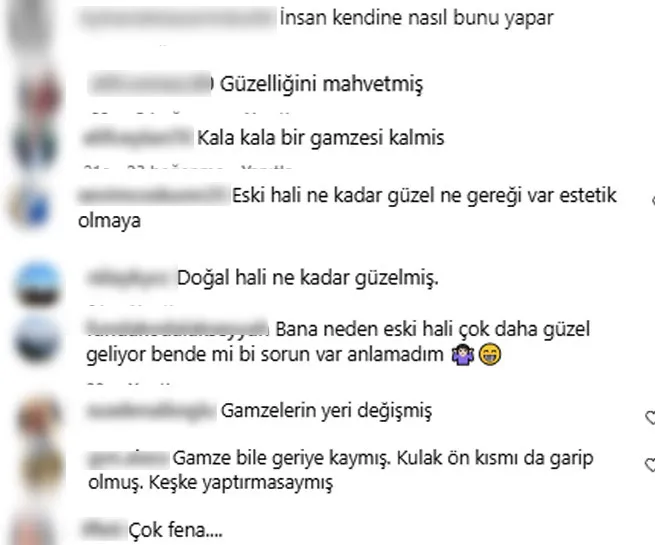 Yüz lifting yaptıran Ebru Yaşar’ın son hali olay oldu: İnsan bunu kendine nasıl yapar? - 5
