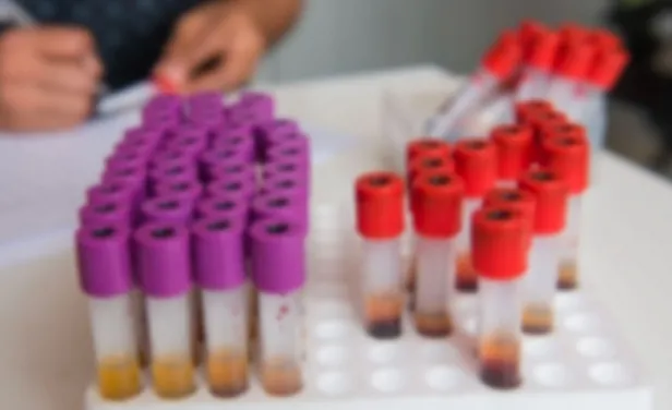 sma-taramasi-nedir-ucretsiz-mi-sma-taramasi-zorunlu-mu-evlilik-oncesinde-sma-taramasi-zorunlu-mu-oldu-bakan-koca-son-dakika-acikladi-1638458773291.jpg Evlilik öncesinde SMA taraması zorunlu mu oldu? Bakan Koca son dakika açıkladı! SMA taraması nedir, ücretsiz mi? SMA taraması zorunlu mu?-4