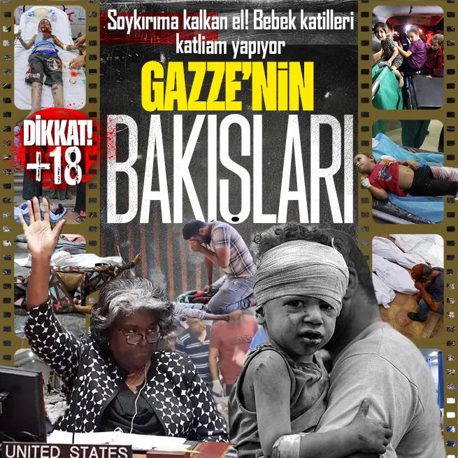 Dikkat!+18 | ABDden soykırıma kalkan el! İşte işgalci İsrailin Gazzede uyguladığı katliamdan vahşet kareleri
