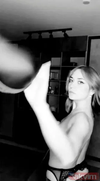 Ameliyattan çıkar çıkmaz fotoğraf paylaştı! Çılgın model sınırları zorladı! Cinsel fotoğraf... - 25