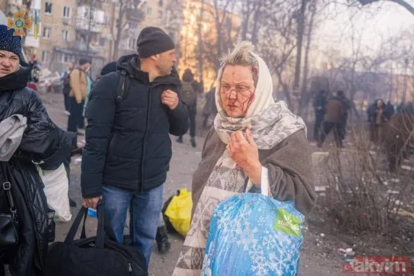 Yüzleri paramparça oldu! Kiev'de siviller bombalandı! - 1