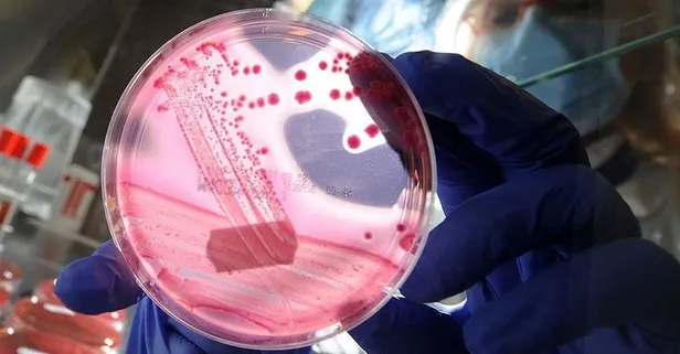 Pankreasa iyi gelenler kırmızı