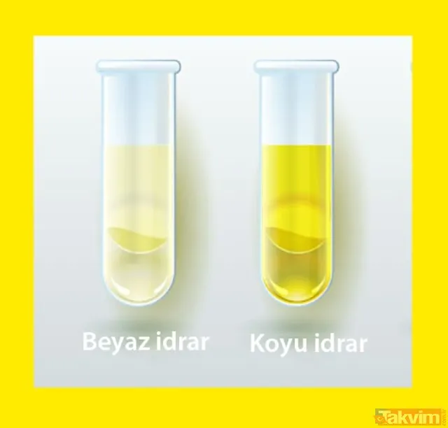 İdrar rengi nasıl olmalı? İdrar rengi değişmesi değişikliği nedenleri