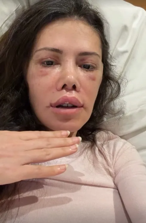 guney-korede-yuz-nakli-yaptiran-didem-ceranin-son-hali-1771060767431.jpg Güney Kore’de yüz nakli yaptıran Didem Ceran’ın son hali-7